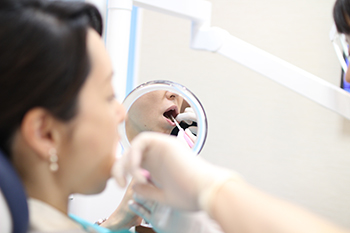 口臭改善、虫歯/歯周病リスクを下げるPMTC(クリーニング)