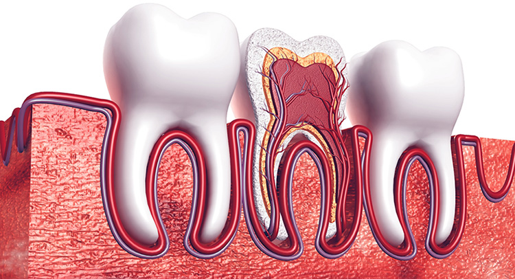 重度の虫歯でも歯を残したい方へ～根管治療のご案内～